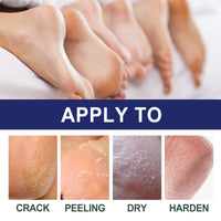 Cracked Heel Ointment, Repair Heel Calluses And Foot Moisturizing Anti-Cracking Peeling Care