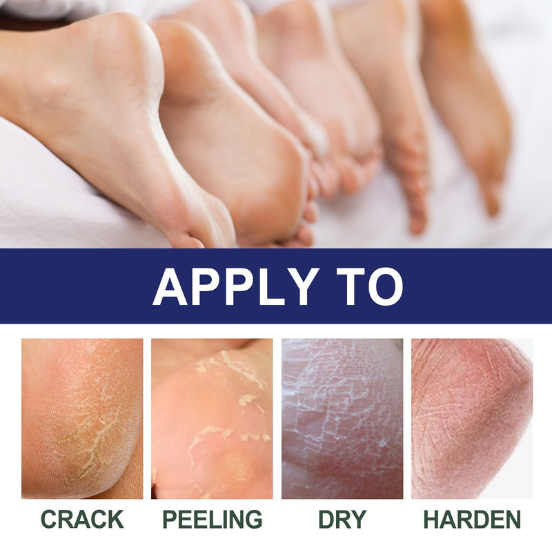 Cracked Heel Ointment, Repair Heel Calluses And Foot Moisturizing Anti-Cracking Peeling Care