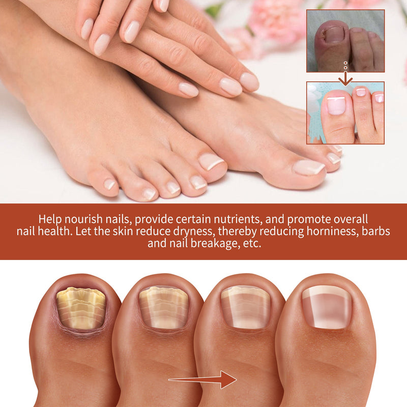 Nail Care Essence Hand And Foot Gray Nail Repair Soft Nail Thickening Moisturizing Nail Care Essence