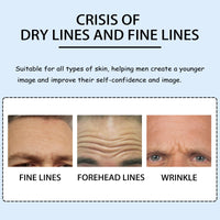 East Moon Anti-Wrinkle Forehead Patch For Men, Firming Forehead And Reducing Fine Lines And Wrinkles