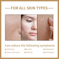 Rice Toner for Face Brightening Serum Oil Control Moisturizing Facial Smooth Sensitive Skin Care Pore Shrinking Essence