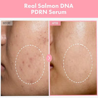 Complex Peptide Acne Serum PDRN Collagen Shrink Pores Fade Melanin Smooth Brightening Skin Korean Skincare Products
