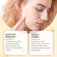 Ximonth Kew Mole Cream Gently Cleanses Skin And Lubrates Rejuvenating Herbal Body Care Cream