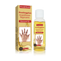 Acanthosis Nigricans Removal Oil, Exfoliating Light Black Brightening And Beauty Skin Oil