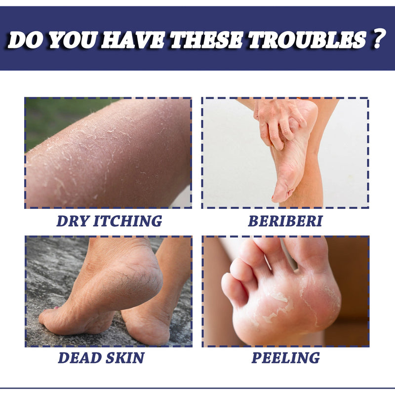 South Moon Urea Hand And Foot Cream, Anti-Crack Peeling Repair Skin Crack Dry Moisturizing Skin Soothes Skin