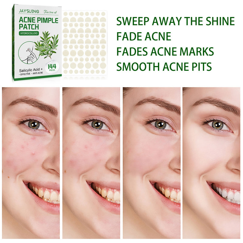 Jaysuing Waterproof Invisible Acne Patch Lighten Acne Acne Print Moisturizing Repair Clear Patch