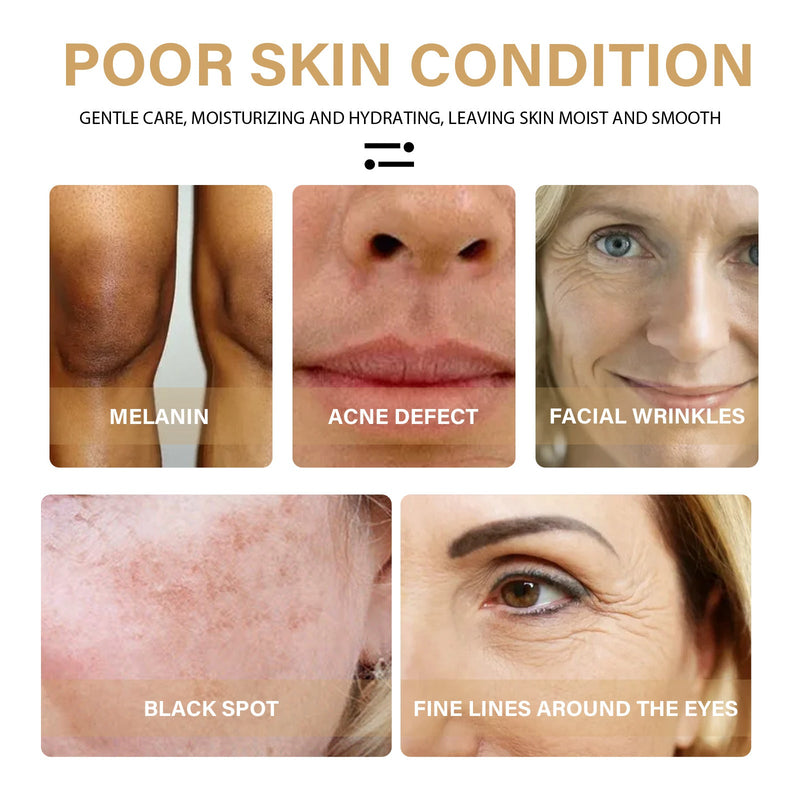 EELHOE Turmeric Correction Essence Facial Care Hydrating Moisturizing Gentle Moisturizing Skin Care Essence