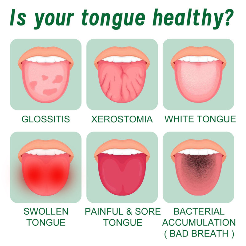 Tongue Repair Spray Repair Tongue Whitening To Relieve Dry, Cracked And Swollen Tongue Oral Care Spray