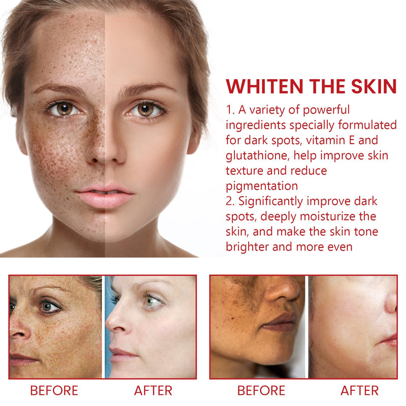 Dark Spot Repair Cream, Restores Dull Skin, Lightening Fine Lines And Dark Spots, Brightening Skin Repair Cream