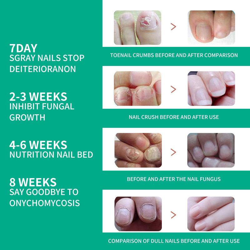 South Moon Nail Care Essence Moisturizes And Cleanses Hands, Feet And Nails And Brightening Nails Daily Care Essence