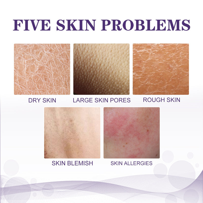 Kp Bump Remover, Deep Moisturizing Cream For Blemishes And Wrinkles