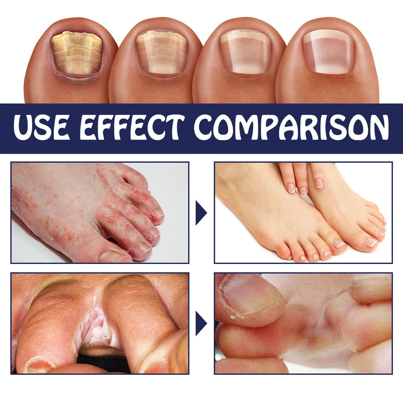 Soothing Cleansing Foot Pain Relief Soak, Relieve Foot Swelling And Pain Gray Nail Moisturizing Care Clean Foot Bath Kit