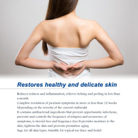 South Moon Psoriasis Relief Spray, Relieve Skin, Hands And Feet Redness Peeling Itch Repair External Care