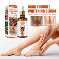 Skin Blackening Essence Brightening Knee Ankle Horn Melanin Removing Moisturizing Essence