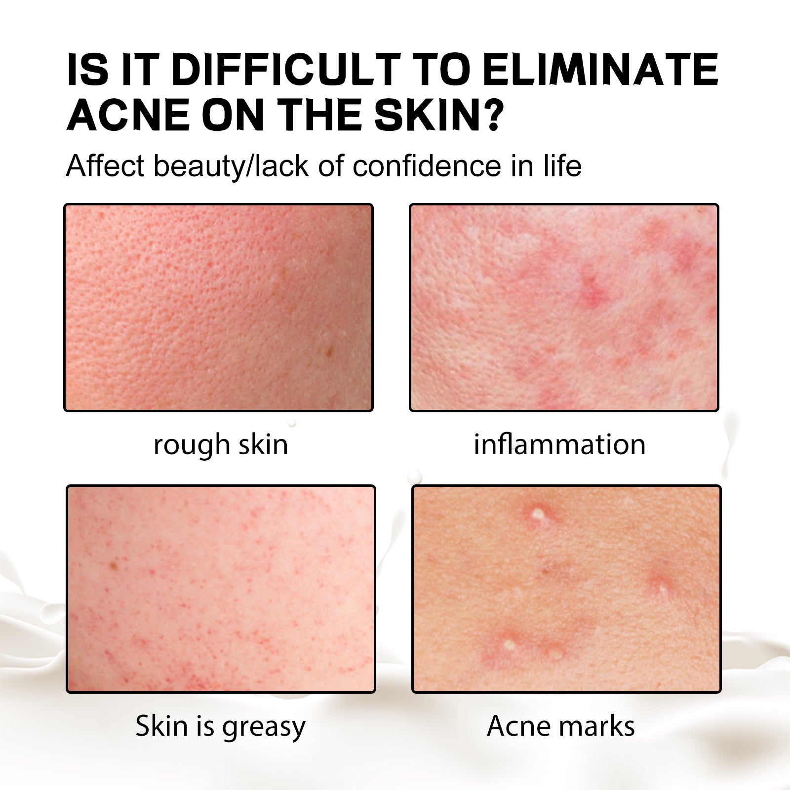 Back Anti-Acne Silk Soap, Body Cleanser Acne Pimple Beauty Back Moisturizing Bath Soap