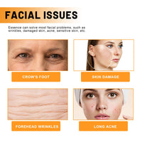 Face Essence Reduces Fine Lines, Brightening Facial Tone, Moisturizing And Hydrating Skin Essence