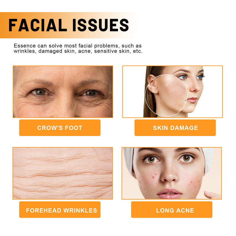 Face Essence Reduces Fine Lines, Brightening Facial Tone, Moisturizing And Hydrating Skin Essence