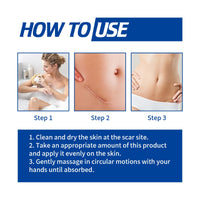 Ouhoe Scar Repair Cream, Gentle Repair Smooth Skin Fade After Scar Scar Skin Repair Cream