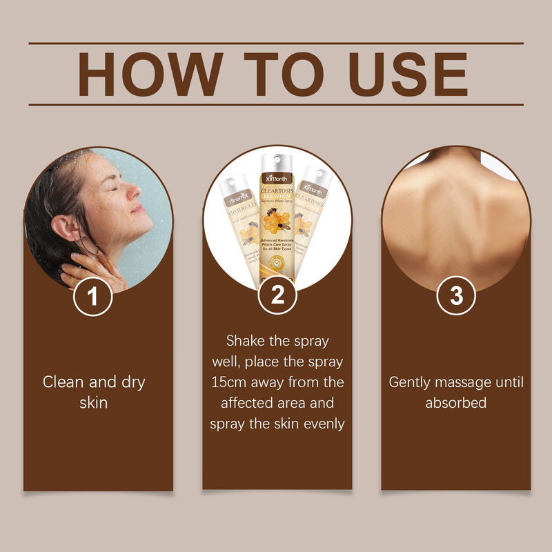 Ximonth Hair Keratosis Treatment Spray Cleans Back Acne And Moisturizes Smooth Body Skin Spray