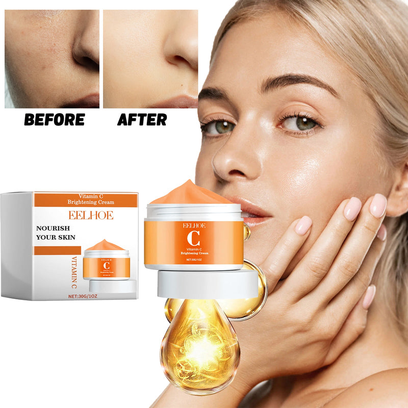 Vitamin C Brightening Cream, Improve Drying To Reduce Fine Lines Held Acne Moist Brightens The Face Cream