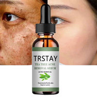 Acne Treatment Face Serum Tea Tree Oil Essence Moisturizing Shrink Pores Acne Facial Serum Korean Skin Care Products