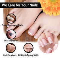 EELHOE Nail Repair Solution Thickening Brightening Nails Removing Gray Nails Dead Skin Repair Nourishing Nail Care Solution