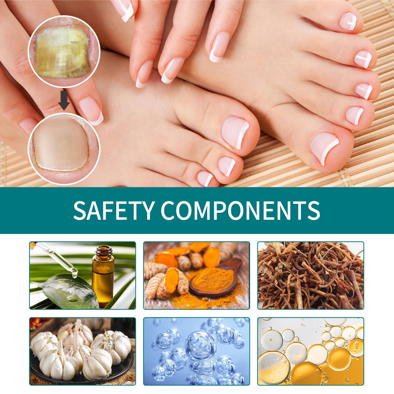 Nail Repair Patch, Hand And Foot Nail Care Soft Nail Inlay Nail Thickening Gray Nails Bright Nails Patch