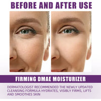 Moisturizer Improves Dry Skin Cream Tightens And Lightens Wrinkles Hydrating Moisturizing Moisture Easy To Absorb