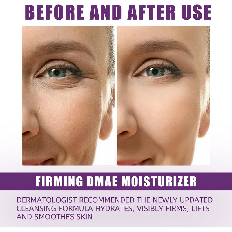 Moisturizer Improves Dry Skin Cream Tightens And Lightens Wrinkles Hydrating Moisturizing Moisture Easy To Absorb
