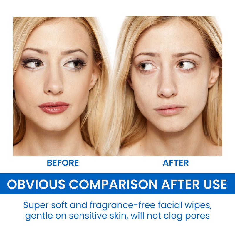 EELHOE Gentle Makeup Remover Wipes Deep Cleanse Face Eye And Lip Makeup Gentle Refreshing Non-Irritating Makeup Remover Wipes