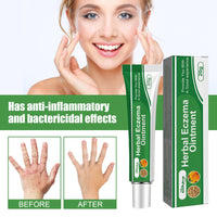 South Moon Herbal Eczema Ointment, Relieve Hand And Foot Moss Skin Redness Itchy Skin Repair Ointment