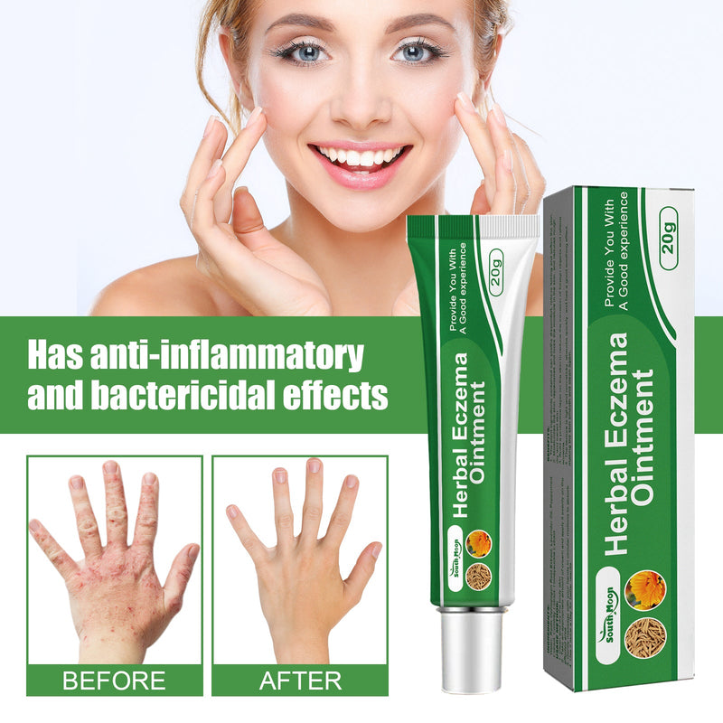 South Moon Herbal Eczema Ointment, Relieve Hand And Foot Moss Skin Redness Itchy Skin Repair Ointment