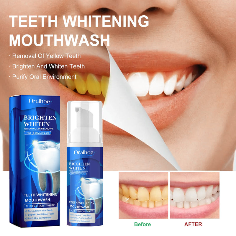 Teeth Whitening Mouthwash, Teeth Cleaning Teeth Yellow Stains Tartar Beauty Teeth Fresh Breath Oral Care