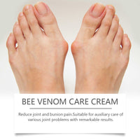 Bee Venom Treatment Cream, Foot Joint Correction Thumb Valgus Swelling Bunion Care Cream