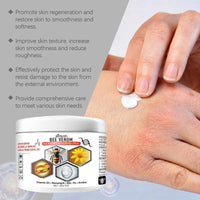 Moss Beesvenom Care Cream Relieves Itchy Skin With Moss Moisturizing Skin Care Cream