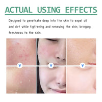 Green Tea Cleansing Mud Mask, Facial Cleansing Moisturizing Whitening Skin Blackhead Acne Removing Mud Mask
