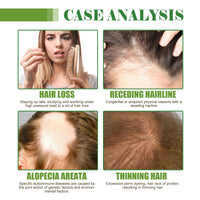 West&Month Hair Care Essential Oil Moisturizes And Protects Dry Hair, Moisturizes And Softens Hair Care Essential Oil
