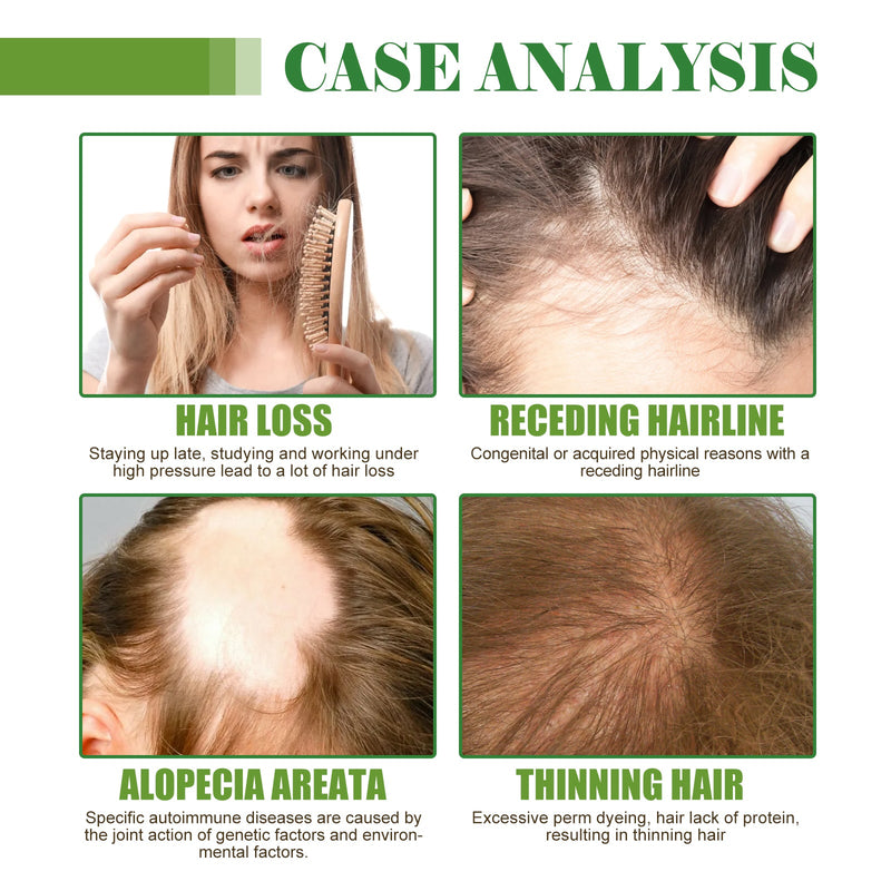 West&Month Hair Care Essential Oil Moisturizes And Protects Dry Hair, Moisturizes And Softens Hair Care Essential Oil