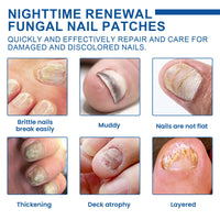 Nighttime Renewal Fungal Nail Patches, Repair And Thickening Gray Nail Insert Soft Nail Care Patch