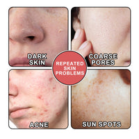 South Moon Nicotinamide Skin Care Essence Facial Skin Hydrating And Firming Skin Care Essence
