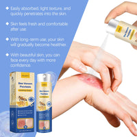 Houkea Skin Care Spray For Delicate Skin All Over The Body Topical Spray Gentle Skin Care Spray