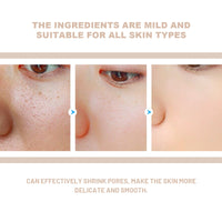 OUHOE Purifying Exfoliating Gel, Skin Mildly Tender Skin Cutin Clean Pores Blackhead Gel