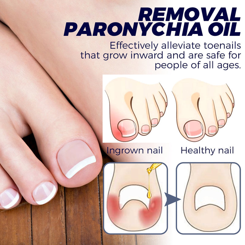 Nail Repair Oil Hand And Foot Repair Inlaid Toenails Soft Nails Daily Moisturizing Nail Care