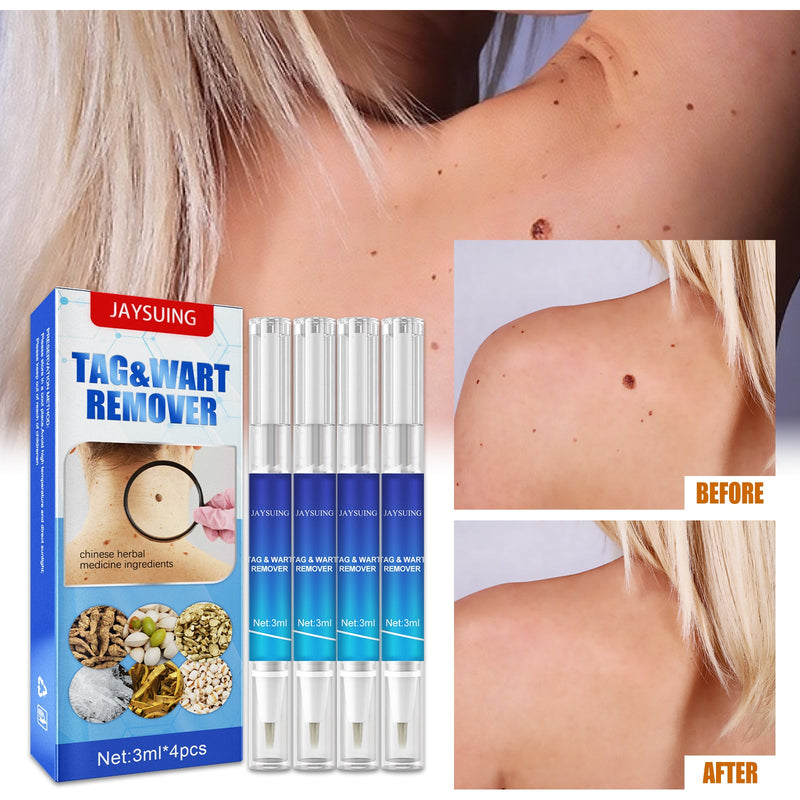 Jaysuing Keyo Care Pen Body Face Flesh Grain Filamentary Skin Clean And Repair Smooth Skin