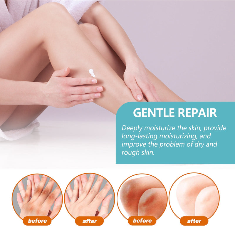 Acanthosis Nigricans Therapy Cream, Moisturizing And Repairing Armpit Joints Arm Black Whitening And Brightening Skin Care Cream