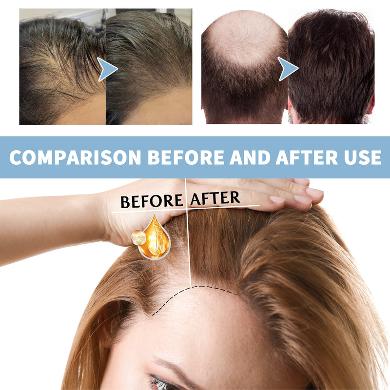Dense Hair Foam Shampoo, Clean Scalp, Moisturize And Thicken Hair, Solid Hair, Fluffy And Smooth Shampoo