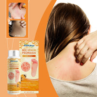 Skin Repair Spray, Nourishes Smooth Skin And Moisturizes Body, Hands And Feet Skin Care Spray