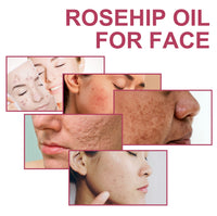Rosehip Oil For Face, Delicate Pores Smooth Repair Facial Moisturizing Fade Acne Blackheads