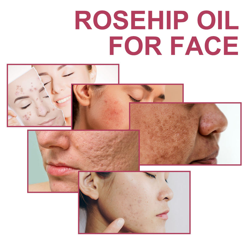Rosehip Oil For Face, Delicate Pores Smooth Repair Facial Moisturizing Fade Acne Blackheads