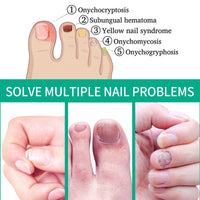South Moon Nail Care Essence Moisturizes And Cleanses Hands, Feet And Nails And Brightening Nails Daily Care Essence